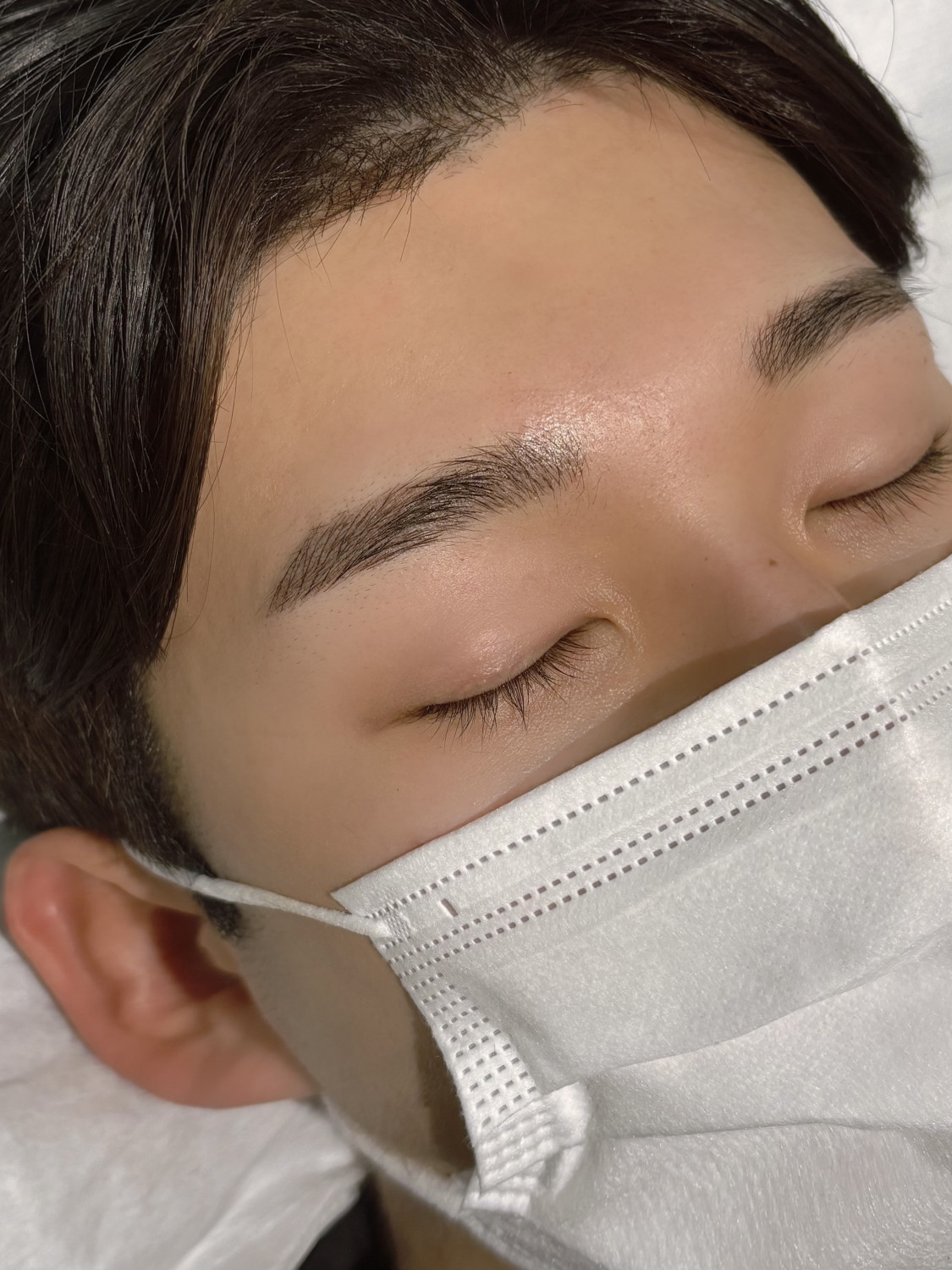 시술사진