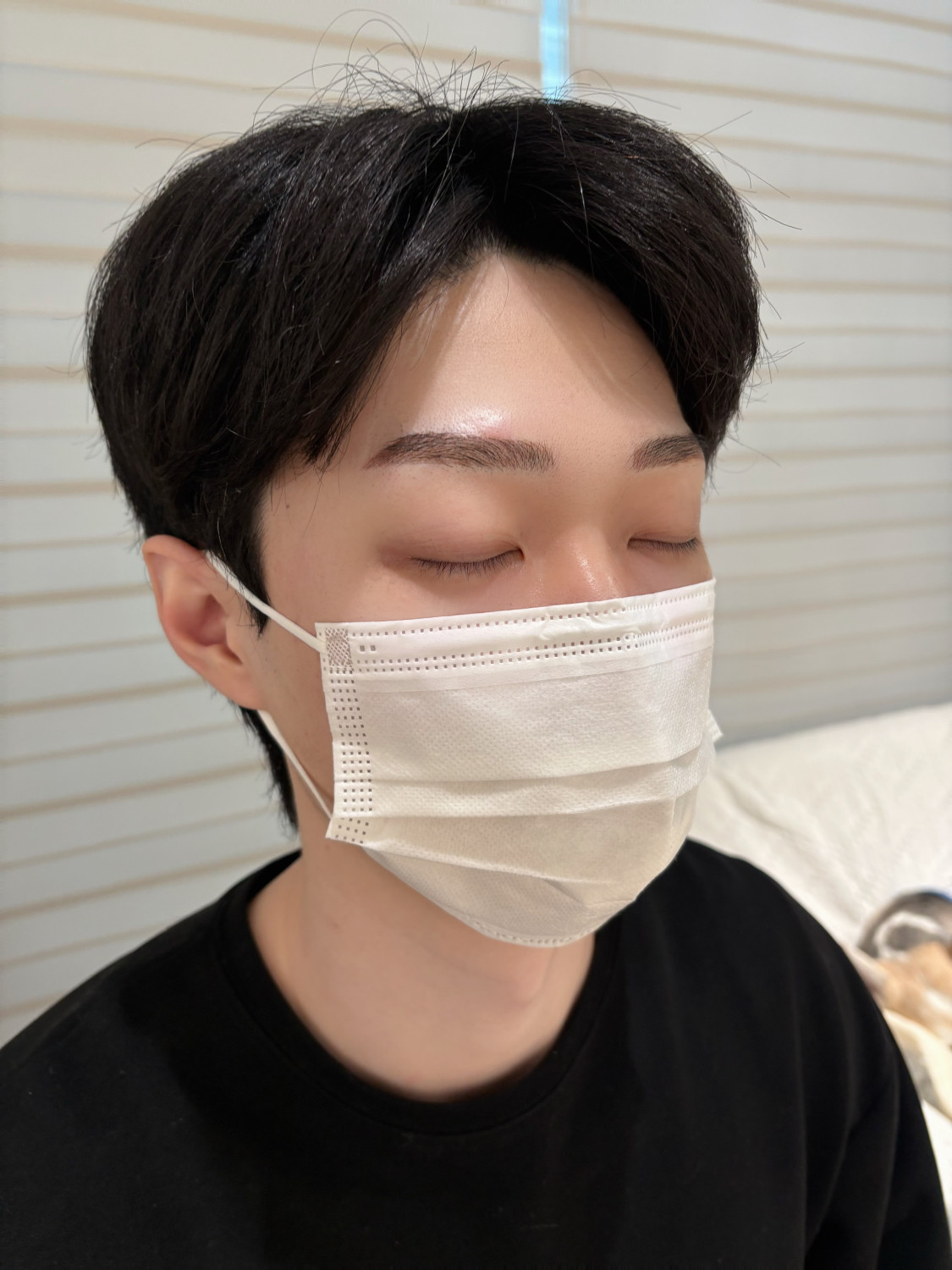 시술사진